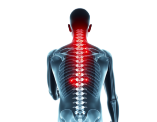 Medical illustration of a man with back pain