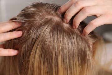 Woman with undying hair roots on blurred background, closeup