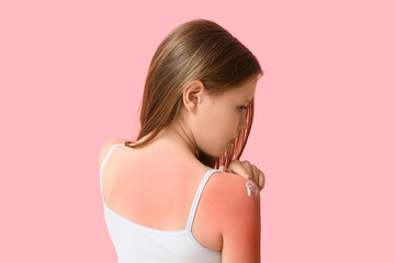Little girl with red sunburned skin applying cream on pink background