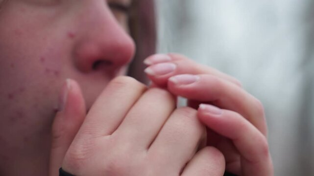 Close-up face view of young woman feeling cold in winter, rubbing hands for warmth, red nose and dry skin highlight harsh weather conditions, blurred background of bare trees enhances