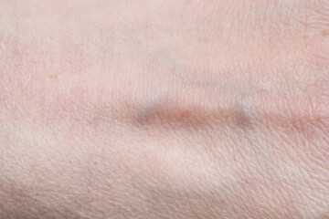 Fototapeta premium Texture of healthy skin as background, closeup