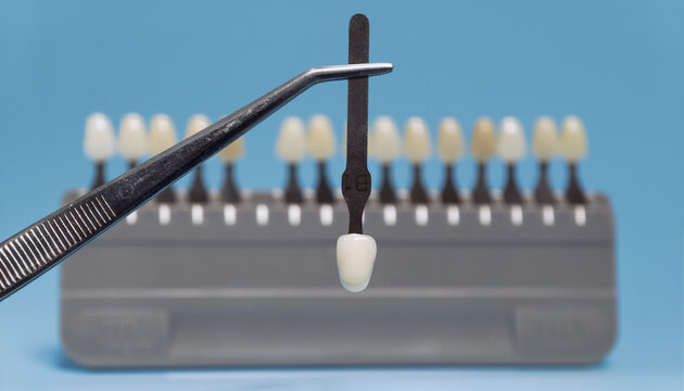 Dental shade guide selection with tweezers