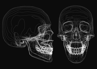 Two skulls are shown side by side, one with a mouth open and the other with a mouth closed. The skulls are in black and white, and the image has a somewhat eerie or ominous mood