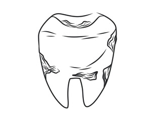 Hand-drawn vector illustration of a decayed tooth. Black and white sketch depicting tooth decay, dental cavities, and oral health problems. Medical, educational, and dentistry-related designs.