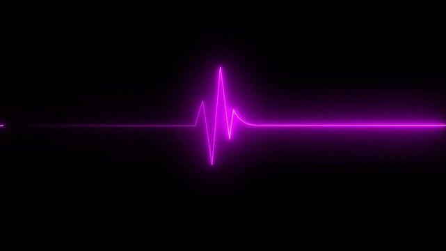 electrocardiogram (EKG or ECG) loop beeping at 60 beats per minute for screen savers or computer monitor displays,