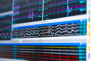 Brain activity data viz. Complex brain activity data displayed on multiple screens, showcasing different types of neural signals in real-time.