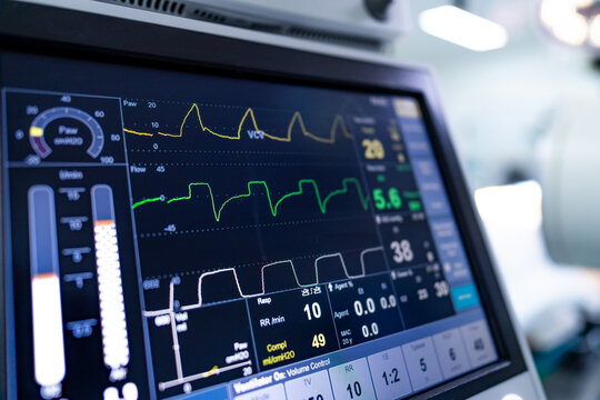 Monitor shows hospital vitals. A hospital monitor shows vital signs and respiratory data of a patient during a medical examination.