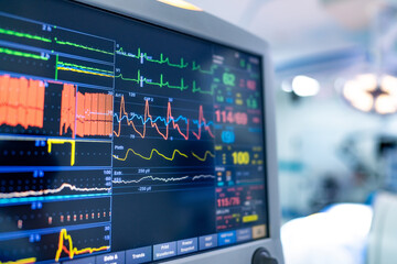 Hospital vital signs monitoring. A medical monitor displays vital signs including heart rate and...