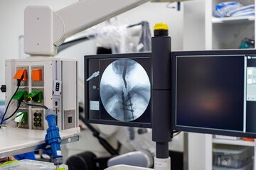 Medical imaging in action. Technicians operate advanced medical imaging equipment in a clinical setting, showcasing real-time diagnostics.