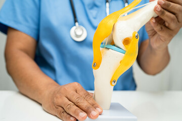 Asian doctor holding spinal nerve and bone model, Lumbar spine displaced herniated disc fragment...