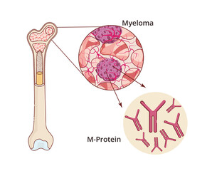 Bone Marrow anatomy vector illustration with red blood cells, white blood cells, and platelets