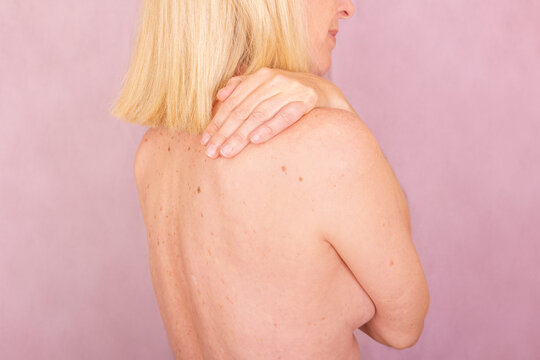 Raising awareness for skin and breast cancer prevention