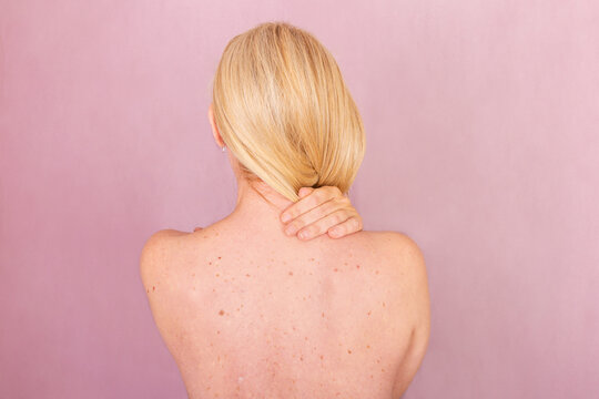 Awareness for Skin and Breast Cancer with Woman's Back Image