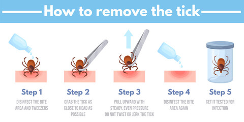 Tick removal. How to remove ticks insect infographics banner, mite bug animal human acarid bite prevention safety protection, tweezers parasite extraction neat vector illustration