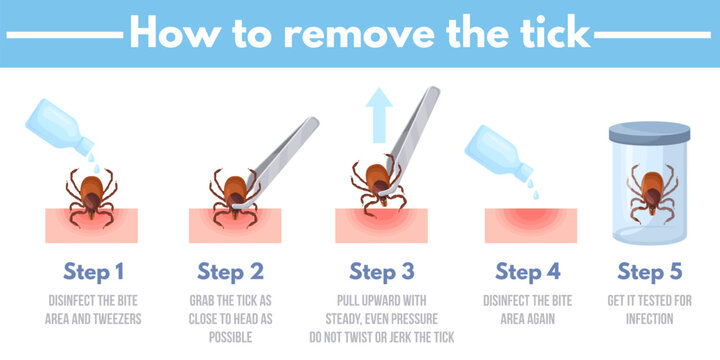 Tick removal. How to remove ticks insect infographics banner, mite bug animal human acarid bite prevention safety protection, tweezers parasite extraction neat vector illustration