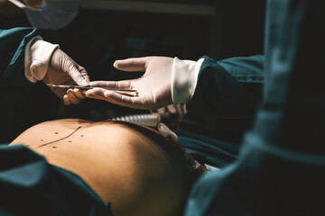staff pass professional doctor medical scissors during operating in emergency room. surgeon get...
