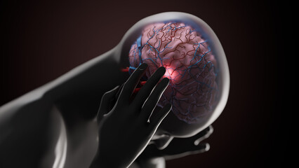 Migraine, conceptual illustration