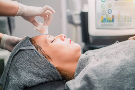 clinic person cleaning asian woman mask using cotton. female patient got cosmetology treatment and remove mask cream by towel. surgeon using tissue wiping cream out patient face skin after procedure