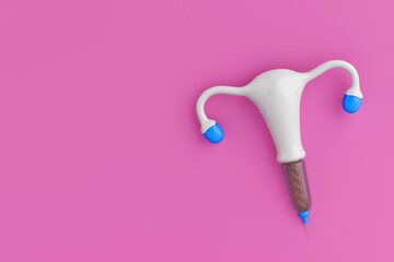 Birth Control Concept. Futuristic Concept of T Shape IUD Copper Intrauterine Device of the Future. 3d Rendering