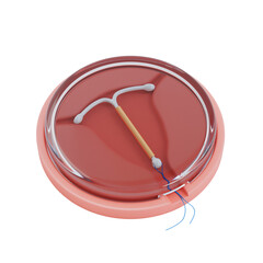 Birth Control Concept. T Shape IUD Copper Intrauterine Device in Plastic Package Case with Glass Lid. 3d Rendering