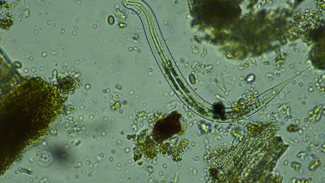 human parasite. gut intestinal infection disease. microorganism infection in hospital