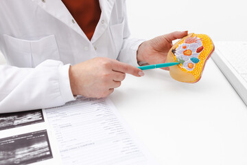 Doctor showing breast tumor or cancer on anatomical model of breast for women's awareness of...