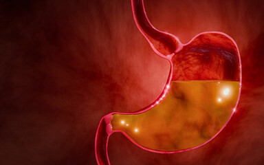 Symptoms of acid reflux or excess acid in the stomach. Gastric juice and intestinal model within the abdominal cavity. Pressure or air causes stomach pain. 3D Rendering.
