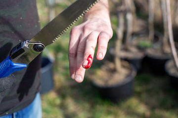 Finger injury with a cut wound caused by a hacksaw due to failure to observe safety precautions...