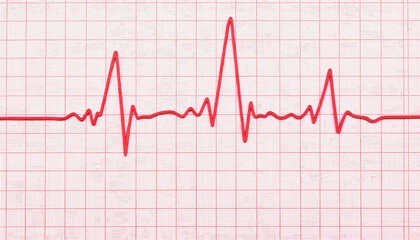Heartbeat waveform on medical graph paper