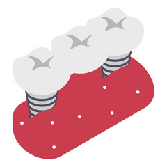 Replacing one Missing Teeth isometric concept, Hybrid Designed Dental Bridge vector icon design, Dentures symbol,Oral Healthcare sign, Dental instrument illustration