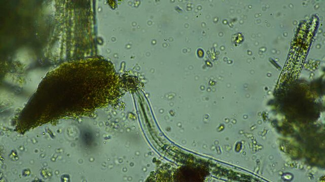 human parasite. gut intestinal infection disease. microorganism infection in hospital