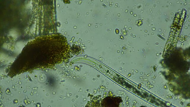 human parasite. gut intestinal infection disease. microorganism infection in hospital