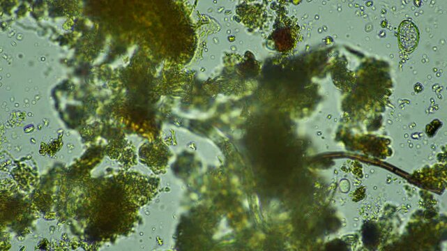 human parasite. gut intestinal infection disease. microorganism infection in hospital