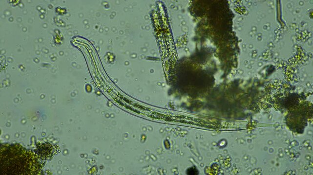 human parasite. gut intestinal infection disease. microorganism infection in hospital