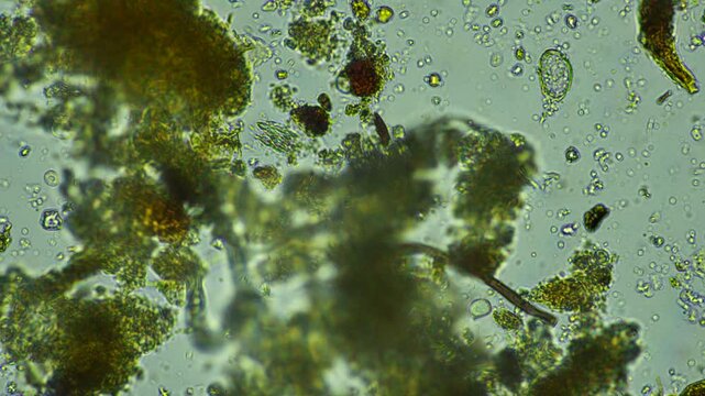 human parasite. gut intestinal infection disease. microorganism infection in hospital