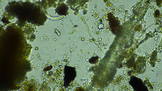 human parasite. gut intestinal infection disease. microorganism infection in hospital