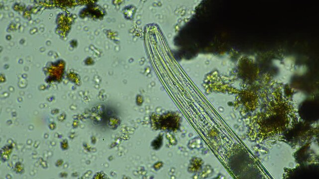 human parasite. gut intestinal infection disease. microorganism infection in hospital