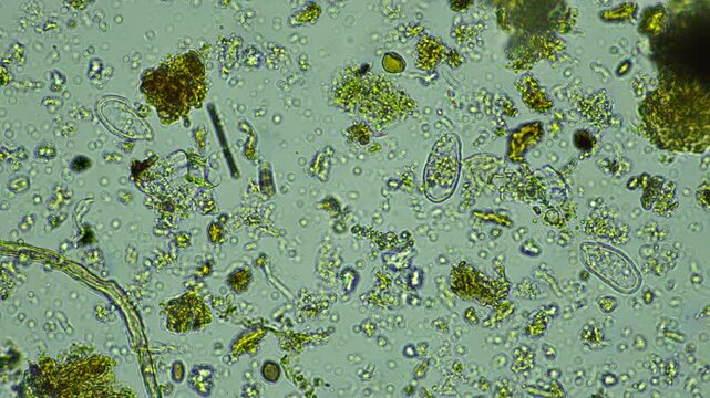 human parasite. gut intestinal infection disease. microorganism infection in hospital