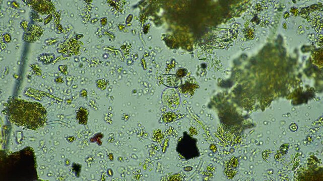 human parasite. gut intestinal infection disease. microorganism infection in hospital