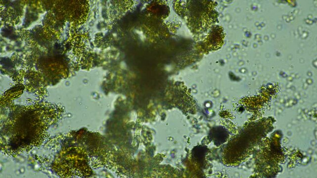 human parasite. gut intestinal infection disease. microorganism infection in hospital