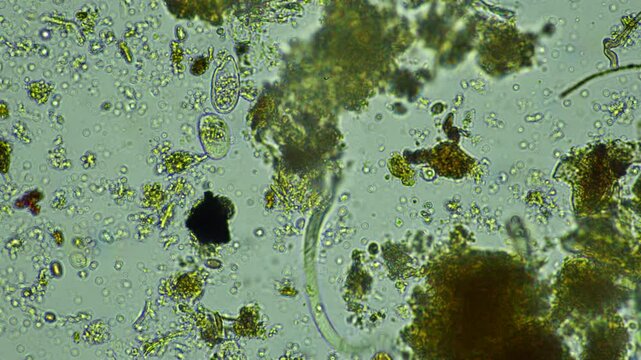 human parasite. gut intestinal infection disease. microorganism infection in hospital