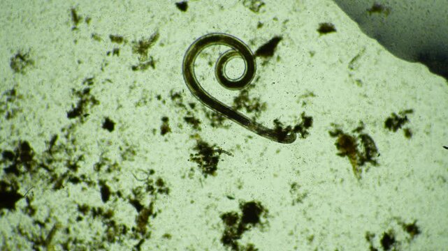 human parasite. gut intestinal infection disease. microorganism infection in hospital