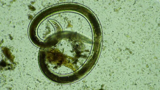 human parasite. gut intestinal infection disease. microorganism infection in hospital