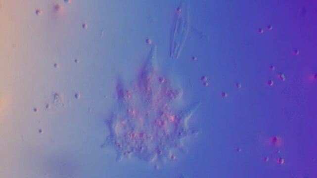 Amoeba among freshwater microbes - 400x DIC microscope, differential interference microscopic observation of amoeba among freshwater microorganisms protozoa microbes aquatic organisms