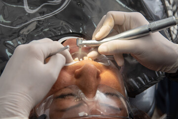 The dentist uses a dental drill to treat a patient's teeth.