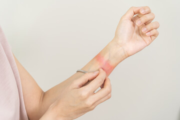 Dermatology asian young woman, girl allergy, allergic reaction dermatitis from wrist bracelet, jewelry on arm, hand in scratching itchy, itch red spot or rash of skin. Healthcare treatment beauty