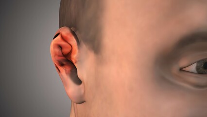 Swollen Ear Anatomy with Auricular Abscess