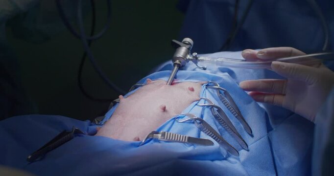 A team of veterinary endoscopists performs surgery on a pet. Close-up of an endoscopic surgery on a pet in veterinary surgery. A veterinarian performs endoscopic sterilization.