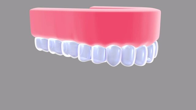 3D animation of a dental cap in a transparent glass graphic style. Before and after placing it on a realistic anatomical denture. On a gray background.