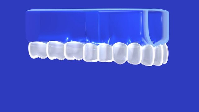 3D animation of a dental cap in a transparent glass graphic style. Placing it on a gum with a transparent denture, which is then rotated. On a blue background.